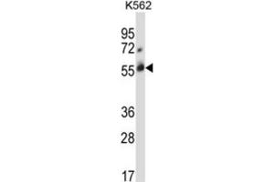 Western Blotting (WB) image for anti-Cbl proto-oncogene C (CBLC) antibody (ABIN2996838) (CBLC 抗体)
