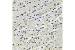 Immunohistochemistry of paraffin-embedded human stomach using H2AFZ antibody (ABIN5973977) at dilution of 1/100 (40x lens). (H2AFZ 抗体)