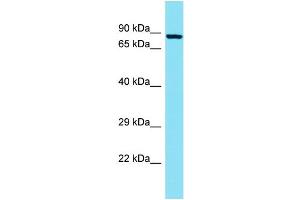 Host: Rabbit Target Name: TCTN2 Sample Type: A549 Whole Cell lysates Antibody Dilution: 1.