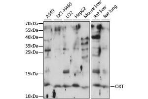 Western blot analysis of extracts of various cell lines, using OXT antibody (ABIN6293432) at 1:1000 dilution. (OXT 抗体)