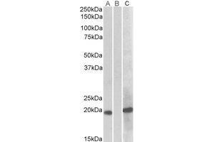 Western Blotting (WB) image for anti-Homeobox A1 (HOXA1) (Internal Region) antibody (ABIN2464864) (HOXA1 抗体  (Internal Region))
