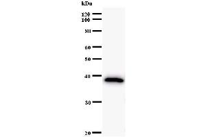 Western Blotting (WB) image for anti-AT Rich Interactive Domain 2 (ARID, RFX-Like) (ARID2) antibody (ABIN933106) (ARID2 抗体)