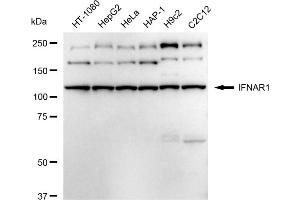 anti-Interferon alpha/beta Receptor 1 (IFNAR1) antibody