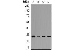 Western blot analysis of Prolactin expression in A549 (A), MCF7 (B), NS-1 (C), H9C2 (D) whole cell lysates. (Prolactin 抗体  (Center))
