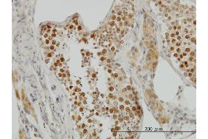 Immunoperoxidase of monoclonal antibody to TOP2A on formalin-fixed paraffin-embedded human testis. (Topoisomerase II alpha 抗体  (AA 1435-1531))