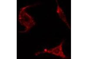 ABIN6278285 staining HepG2 cells by IF/ICC. (ENAH 抗体  (Internal Region))