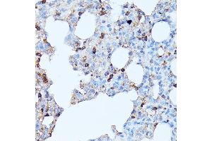 Immunohistochemistry of paraffin-embedded rat lung using CXCR1 antibody (ABIN7266317) at dilution of 1:100 (40x lens). (CXCR1 抗体  (AA 250-350))