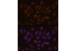 Immunofluorescence (IF) image for anti-High Density Lipoprotein Binding Protein (HDLBP) (AA 1035-1268) antibody (ABIN6141701)