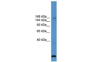 WB Suggested Anti-USP47  Antibody Titration: 0. (USP47 抗体  (Middle Region))
