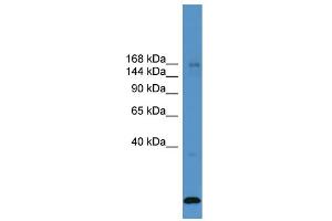 WB Suggested Anti-USP47  Antibody Titration: 0. (USP47 抗体  (Middle Region))