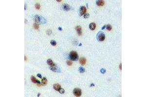 Immunohistochemical analysis of MeCP2 staining in mouse brain formalin fixed paraffin embedded tissue section. (MECP2 抗体)