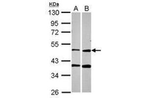 Image no. 1 for anti-Protoporphyrinogen Oxidase (PPOX) (AA 179-418) antibody (ABIN1500380) (PPOX 抗体  (AA 179-418))