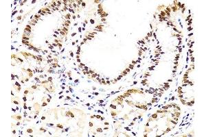 Immunohistochemistry (Paraffin-embedded Sections) (IHC (p)) image for anti-Proliferating Cell Nuclear Antigen (PCNA) (AA 1-261) antibody (ABIN3020826)