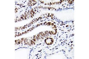 Immunohistochemistry of paraffin-embedded human colon carcinoma using MCM2 Rabbit mAb (ABIN7268538) at dilution of 1:100 (40x lens). (MCM2 抗体)