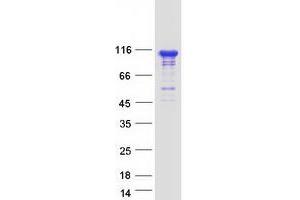 Validation with Western Blot
