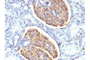 Formalin-fixed, paraffin-embedded human Kidney stained with AIF1 / Iba1 Mouse Monoclonal Antibody (AIF1/1909). (Iba1 抗体  (AA 1-146))