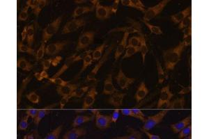 Immunofluorescence analysis of C6 cells using EIF5B Polyclonal Antibody at dilution of 1:100. (EIF5B 抗体)