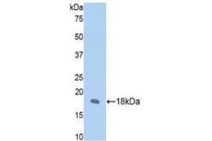 Western blot analysis of recombinant Rat FBN1. (Fibrillin 1 抗体  (AA 751-895))
