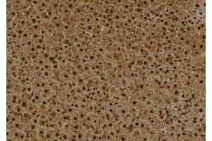 ABIN6260236 and ABIN6273993 at 1/100 staining Rat liver tissue by IHC-P. (BCL6 抗体  (Internal Region))