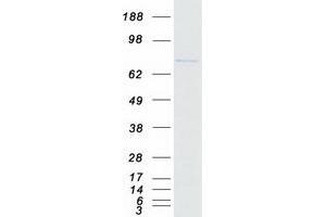 Western Blotting (WB) image for Phospholipase A2, Group VI (Cytosolic, Calcium-Independent) (PLA2G6) (Transcript Variant 2) protein (Myc-DYKDDDDK Tag) (ABIN2729084)