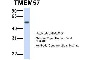 Host:  Rabbit  Target Name:  TMEM57  Sample Type:  Human Fetal Muscle  Antibody Dilution:  1. (TMEM57 抗体  (N-Term))