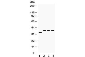 Western blot testing of 1) rat brain, 2) human SW620, 3) human 22RV1 and 4) human Hela lysate with DARPP-32 antibody. (DARPP32 抗体)