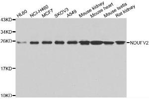 Western blot analysis of extracts of various cell lines, using NDUFV2 antibody. (NDUFV2 抗体)