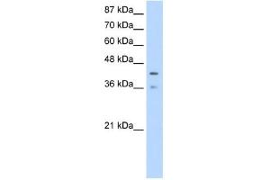 PCBP4 antibody used at 1. (PCBP4 抗体)
