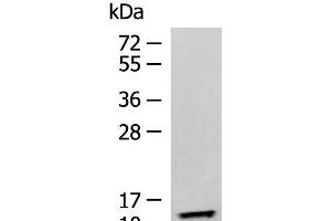 Western blot analysis of Human fetal liver tissue lysate using TMEM141 Polyclonal Antibody at dilution of 1:900 (TMEM141 抗体)