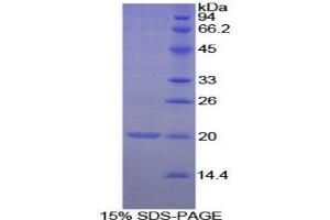 SDS-PAGE analysis of Mouse Matrix Gla Protein. (MGP 蛋白)