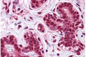 Human Breast: Formalin-Fixed, Paraffin-Embedded (FFPE) (LMBRD1 抗体  (C-Term))