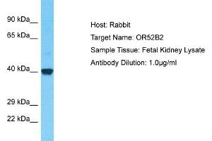 Host: Rabbit Target Name: OR52B2 Sample Type: Fetal Kidney lysates Antibody Dilution: 1. (OR52B2 抗体  (C-Term))