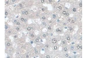 Immunohistochemistry (IHC) image for anti-Glutathione S-Transferase mu 4 (GSTM4) (AA 21-215) antibody (ABIN7444301)