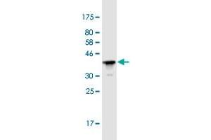 Western Blot detection against Immunogen (36. (Plakophilin 3 抗体  (AA 225-324))