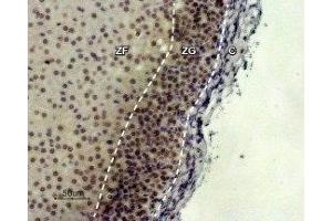 Immunohistochemistry (IHC) image for anti-Melanocortin 2 Receptor (Adrenocorticotropic Hormone) (MC2R) (AA 87-99), (Extracellular) antibody (ABIN7043322)