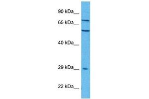 Host:  Rabbit  Target Name:  FZD7  Sample Tissue:  Human A549 Whole Cell  Antibody Dilution:  1ug/ml (FZD7 抗体  (C-Term))
