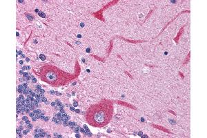 Immunohistochemistry (IHC) image for anti-Glutamate Receptor, Ionotropic, N-Methyl D-Aspartate 2c (GRIN2C) (AA 69-118) antibody (ABIN6736392)