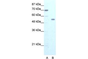 Western Blotting (WB) image for anti-Zinc Finger Protein 665 (ZNF665) antibody (ABIN2461273) (ZNF665 抗体)