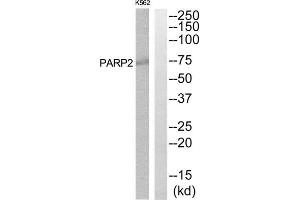 Western Blotting (WB) image for anti-Poly (ADP-Ribose) Polymerase 2 (PARP2) (Internal Region) antibody (ABIN1850490)