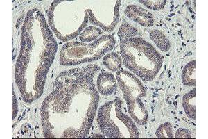 Image no. 6 for anti-rho GTPase Activating Protein 2 (ARHGAP2) antibody (ABIN1499629)