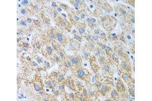 Immunohistochemistry of paraffin-embedded Human liver using UBE2U Polyclonal Antibody at dilution of 1:100 (40x lens). (UBE2U 抗体)