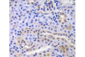 Immunohistochemistry of paraffin-embedded Mouse kidney using PSMA6 Polyclonal Antibody at dilution of 1:100 (40x lens). (PSMA6 抗体)