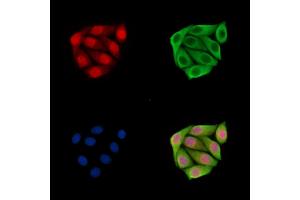 ABIN7096723 and ABIN7100788 staining Hela cells by IF/ICC. (EXOSC6 抗体)