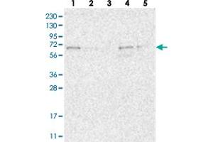 Western blot analysis of Lane 1: RT-4, Lane 2: U-251 MG, Lane 3: Human Plasma, Lane 4: Liver, Lane 5: Tonsil with FAM63A polyclonal antibody . (FAM63A 抗体)