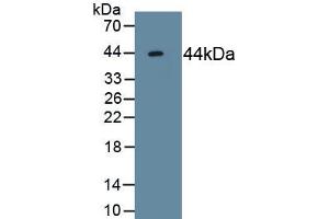 Detection of Recombinant ACVR2A, Human using Monoclonal Antibody to Activin A Receptor Type II A (ACVR2A) (ACVR2A 抗体  (AA 20-135))