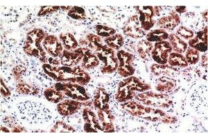 Immunohistochemistry of paraffin-embedded Human kidney tissue using CST3 Monoclonal Antibody at dilution of 1:200. (CST3 抗体)