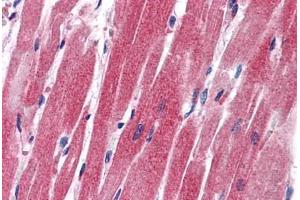 Human Heart: Formalin-Fixed, Paraffin-Embedded (FFPE) (SLUG 抗体  (AA 92-141))