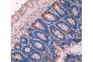 Immunohistochemistry (Paraffin-embedded Sections) (IHC (p)) image for anti-Calpain 1, Large Subunit (CAPNL1) (AA 387-694) antibody (ABIN2901959)