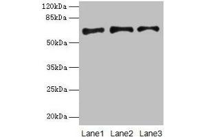 Western blot All lanes: PLAT antibody at 16 μg/mL Lane 1: Jurkat whole cell lysate Lane 2: Mouse stomach tissue Lane 3: Mouse kidney tissue Secondary Goat polyclonal to rabbit IgG at 1/10000 dilution Predicted band size: 63, 33, 58, 45 kDa Observed band size: 63 kDa (PLAT 抗体  (AA 36-556))