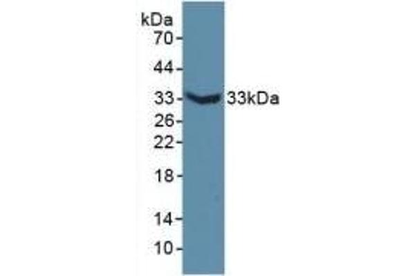 MAP6 抗体  (AA 177-387)